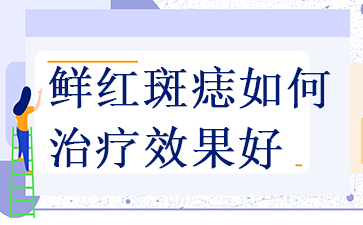 广州鲜红斑痣可以根治吗-鲜红斑痣如何治疗效果好
